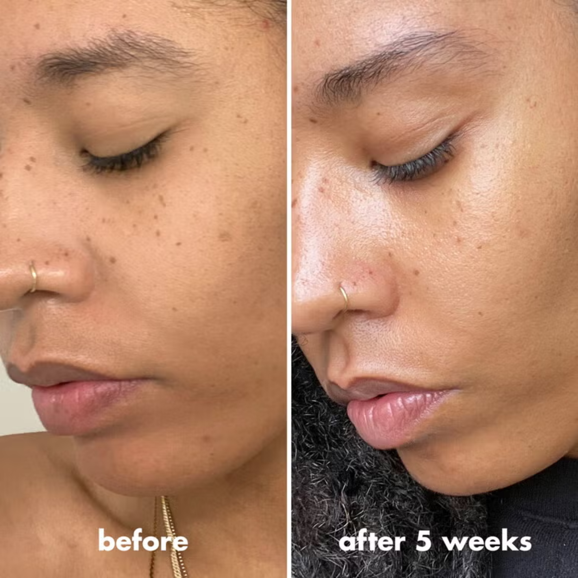Voor en na gebruik van e.l.f. C-Brightening Putty Primer voor een egalere en stralendere teint.