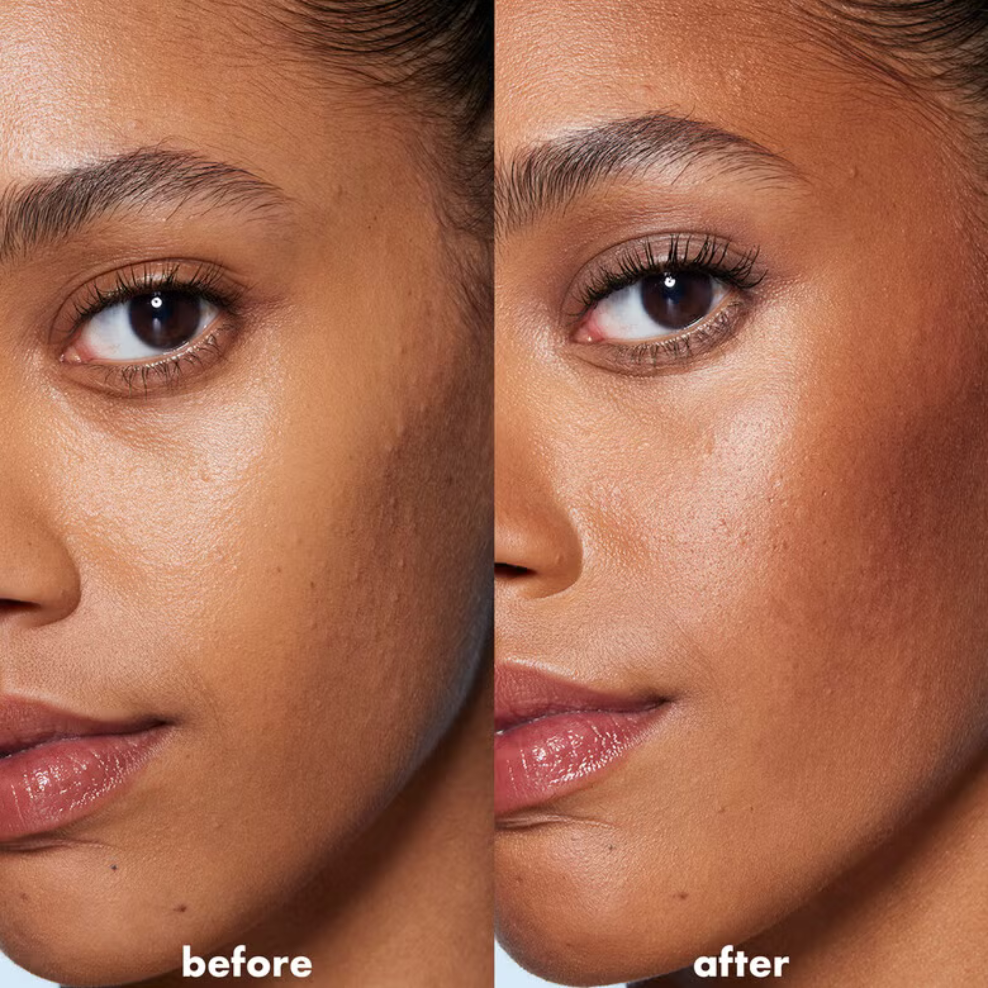 Before and after comparison of a woman's face with visible skin texture differences.